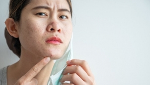 'Maskne' ile başa çıkmanın 2 yolu